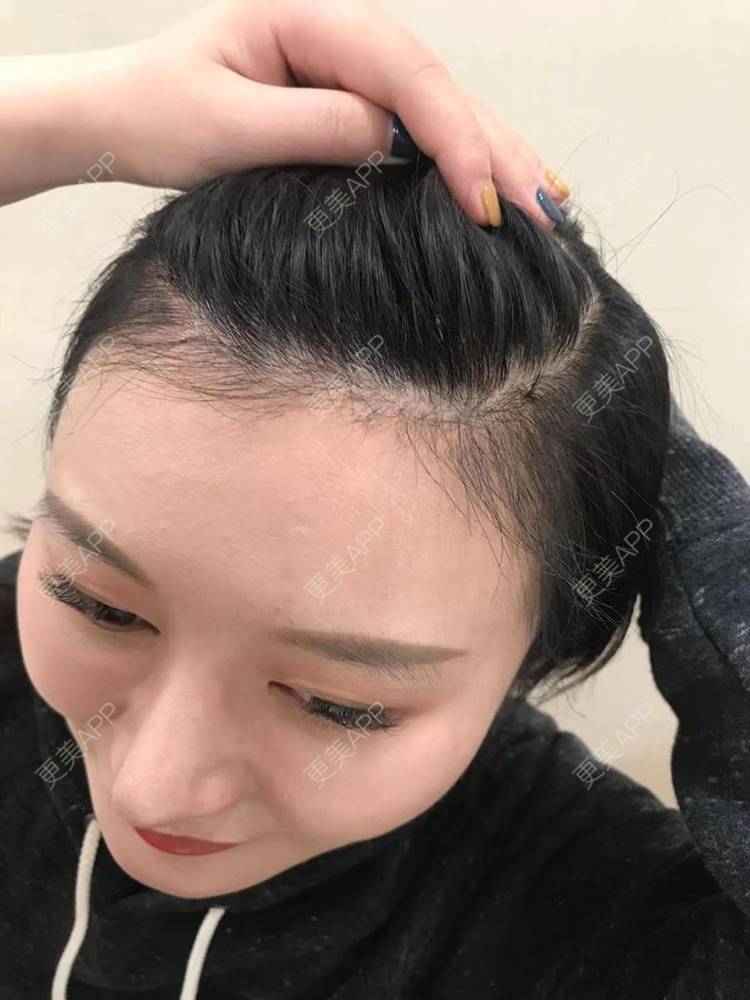 TP钱包怎么看K线_钱包线头怎么处理_tp钱包如何看k线